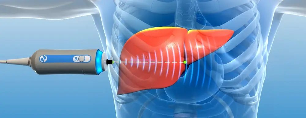 Badanie FibroScan